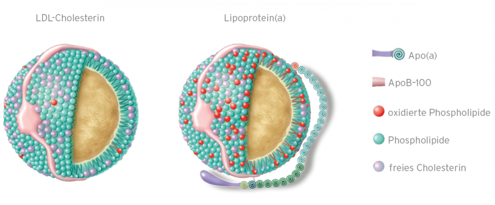 Lipoproteinapherese AFI