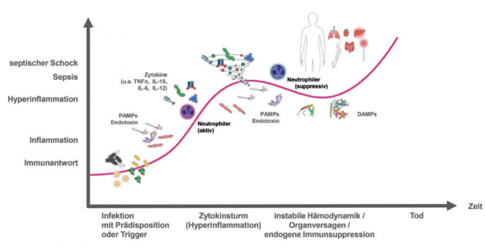 Innovative Ansätze in der Sepsis-Therapie